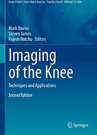 Imaging of the Knee